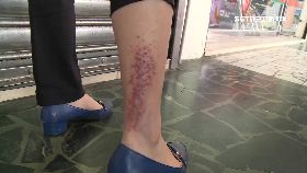 w泡溫泉爛腿1600