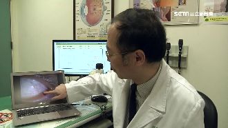 人工淚液用剩捨不得丟　蟲鑽少女眼睛