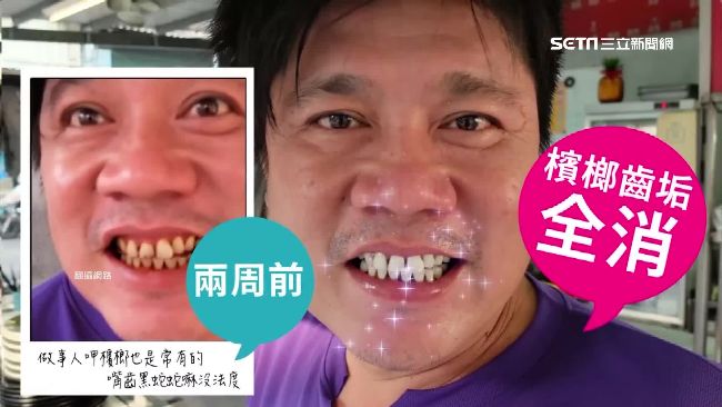 兩周就變美白齒？揭密網購中藥潔牙粉