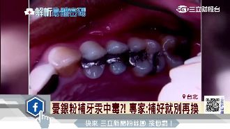 憂銀粉補牙汞中毒？專家：補好就別換