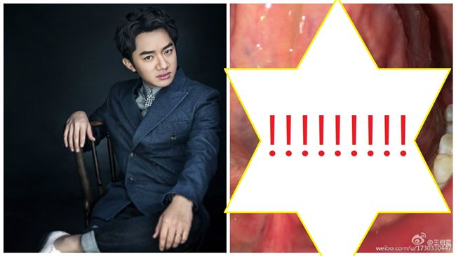 男星PO照勸大家別點　網友嚇喊賠錢