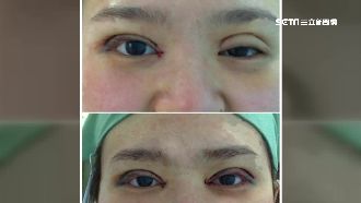 5天速成整形名醫　陸黑心醫美曝光