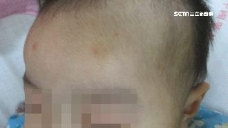 醫院40天收10嬰急診　7嬰疑遭虐