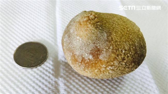 防結石　醫說尿量要達這個數字才有效