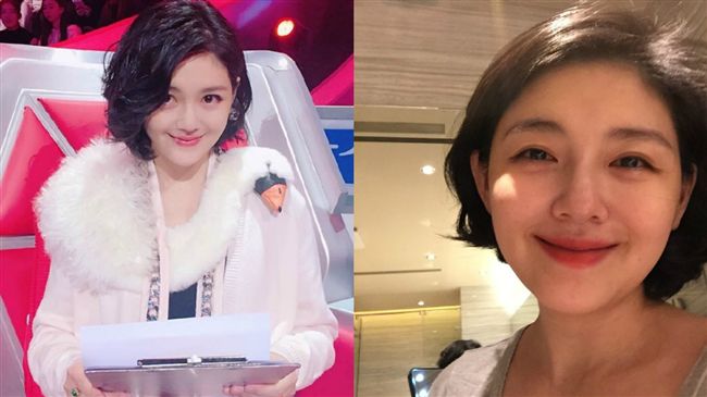 大S宿疾二尖瓣脫垂　昔失去心跳送醫救治