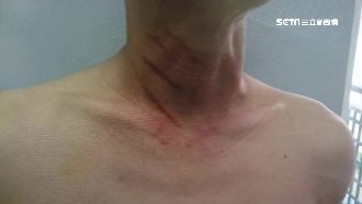 水果攤月入百萬　遭黑道毆打逼簽本票