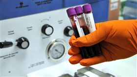 血液檢驗,捐血,醫療,醫檢師（圖／美聯社／達志影像）