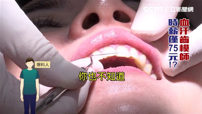 假牙成本百元開價逾萬　揭露診所暴利