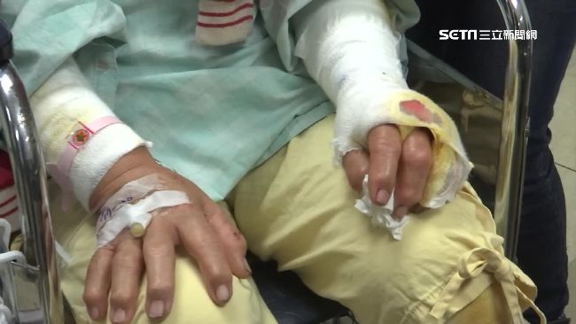 恐怖野狗圍攻晨運嬤　衣服碎爛全身傷