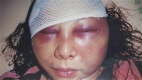 民進黨台北市議員童仲彥對妻子李秀環施暴、家暴、暴力、毆打（圖／李秀環提供）