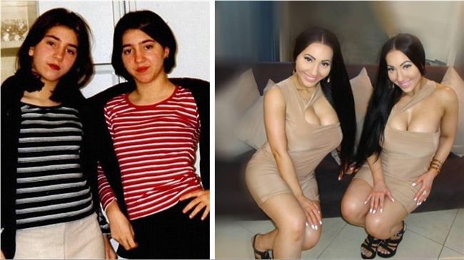 爆乳姐妹砸8百萬整型　最後超後悔…