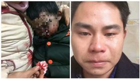 中國大陸，近親生子，男童，罕見疾病（圖／翻攝自今日宜賓微博）
