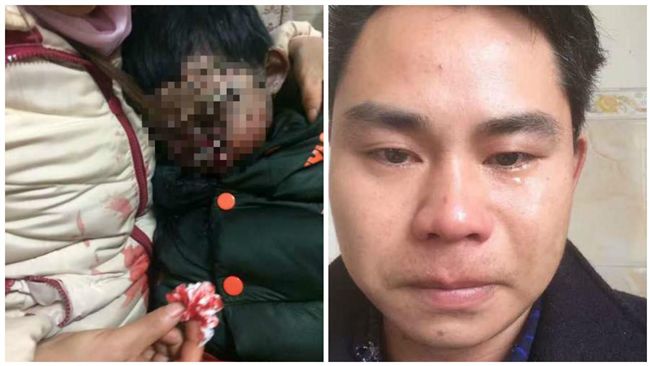 表兄妹近親生子　男童恐僅剩1年生命