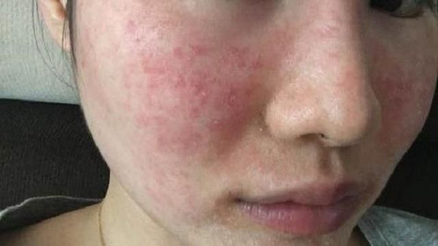 空汙讓皮膚科擠爆　學日本女人自救術
