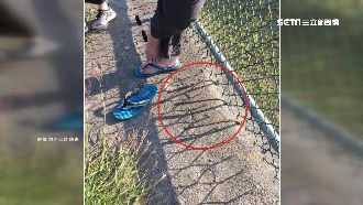 3根鋼筋裸露路邊　路人踢到腳趾濺血