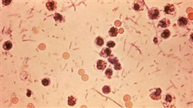 志賀氏桿菌會導致嚴重腸胃炎。（圖／翻攝自wiki）