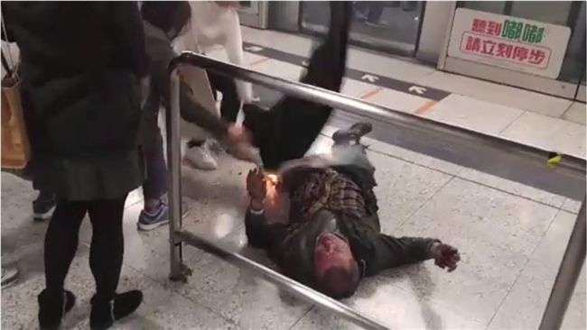 港鐵縱火案　台灣女乘客二級燒傷危殆