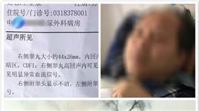 攝影師,東網,大陸,煙火,新人,婚禮,手術,醫生,婚宴,律師,賠償,僱傭　圖／東網https://goo.gl/BAXDfx