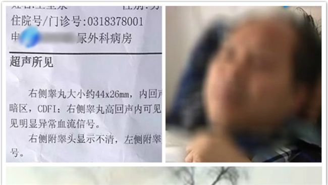 遭婚宴禮炮炸傷　攝影師下體恐將切除