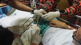 陰莖環,馬來西亞,吉隆坡,消防員,案件,醫院,就醫,沙巴尼,Samsol Maarif Saibani(星報 http://www.thestar.com.my/news/nation/2017/01/01/bomba-ring-around-the-penis/)