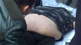 拯救胖子/平安硚口微博