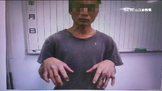 想當義消遭拒　前科男買瀝青潑救護車