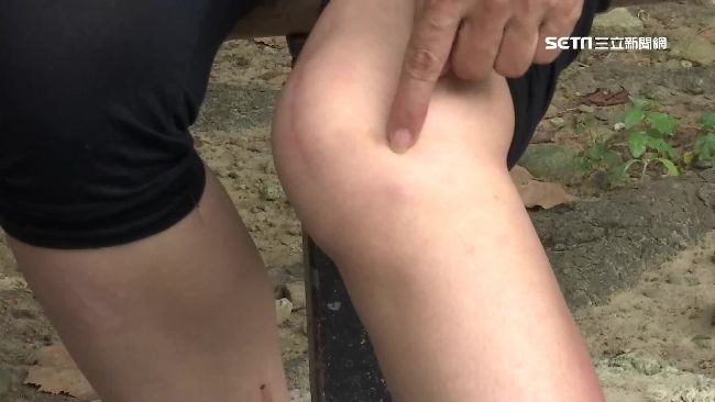 骨質疏鬆不只會發生在老年人身上,年輕人與中年人也都是高危險族群。(示意圖/資料照)
