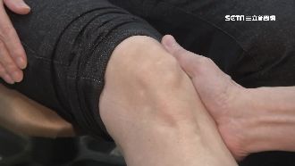 原要換關節 他認真「做1動作」半年後不痛