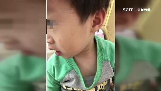 2歲兒臉腫大哭　母控老師狠心呼巴掌