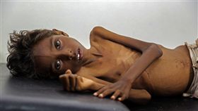UNICEF,飢荒,飢餓,難民,營養不良,兒童,（圖／翻攝自聯合國兒童基金會中文官網）https://goo.gl/lTzY56