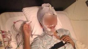 網路瘋傳富田真由的毀容照。（圖／翻攝自推特）