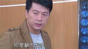 春花望露,顱內出血,電腦斷層掃描（圖／翻攝自王樹偉臉書）