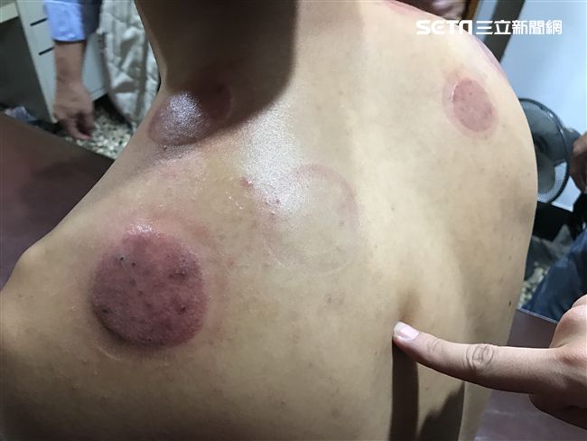 《青春好7淘》主持人外景竟意外受傷