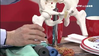 跌倒臥床礙健康　1年內死亡率破3成