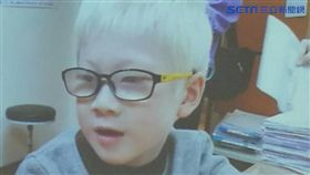 醫師林育葳說，罹患白化症的董小弟，5歲時來台接受視力治療，視力從原本的0.1進步到0.4。（圖／楊晴雯攝）