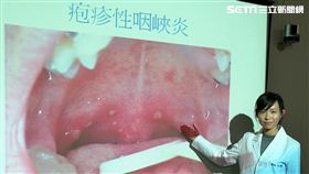 醫師吳佩圜提醒，預防腸病毒應用肥皂勤洗手，流行期間避免出入人潮擁擠的公共場所。（圖／記者楊晴雯攝）