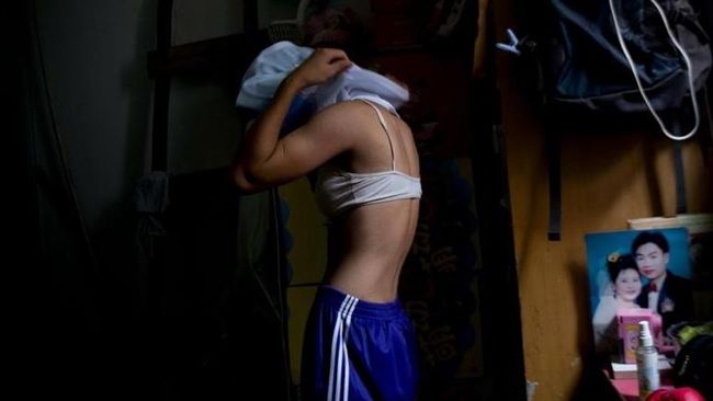 19歲少女月經沒來　一檢查竟是男的
