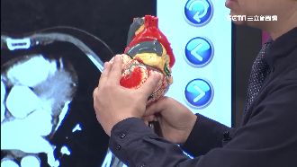 低溫來襲！心血管疾病患者多關「心」