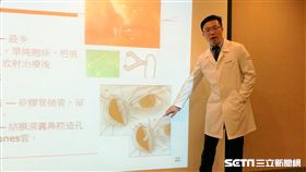 ▲醫師江尚宜說明，鼻淚管阻塞，就像是下水道不通暢，因此雖然分泌的淚水量正常，卻會滿溢出來。（圖／記者楊晴雯攝）