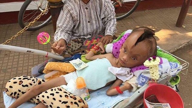 男童頭裂10公分　從前額延伸到後腦