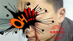  福州男頭插水果刀照排隊(圖/翻攝自《海峽都市報》)