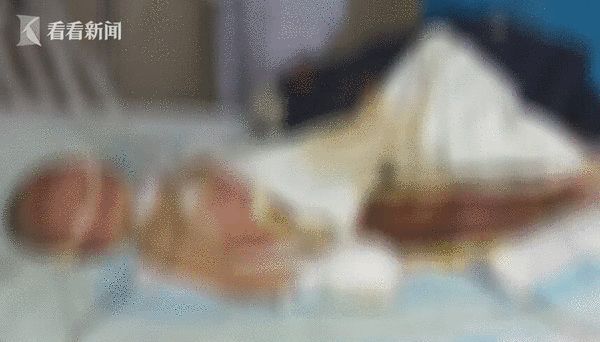 4歲姊火海救1歲妹　全身著火重傷