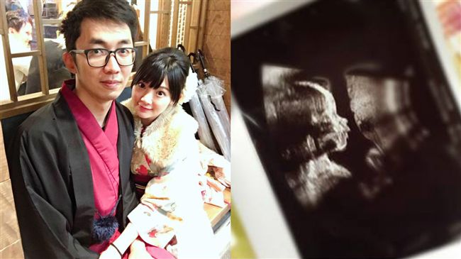 殺梗甜親老婆孕肚　優格姐姐喜當媽媽