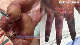 受傷當時ｖｓ治療後。