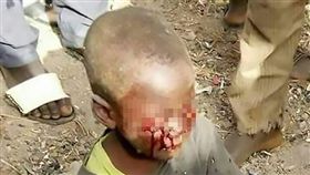 繼母,辛巴威,挖爛,狠心,尿床 
圖／翻攝自鏡報