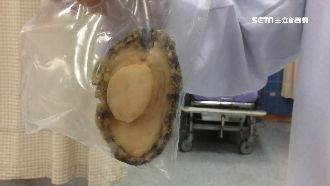 吃「大鮑魚」噎到　老翁送醫急救命危
