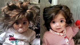 女嬰髮量超多。（圖／翻攝自每日郵報）