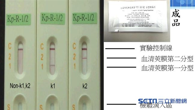 獨步全球！台診斷肺炎菌只需3分鐘
