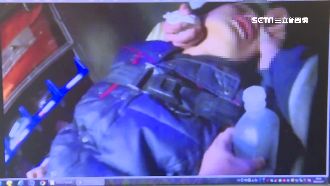 遭菸燙傷打119　友還譙救護員髒話