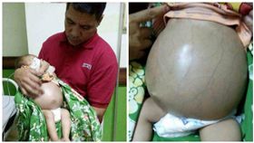 印尼，男嬰（圖／翻攝自太陽報）